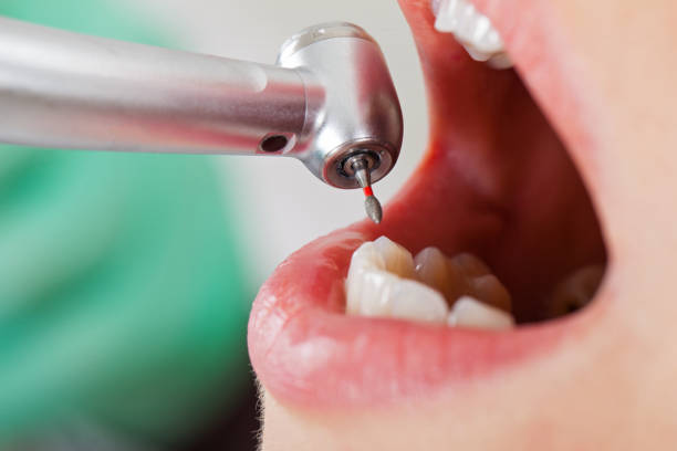 Best Weekend Emergency Dentist in Lowell, MA